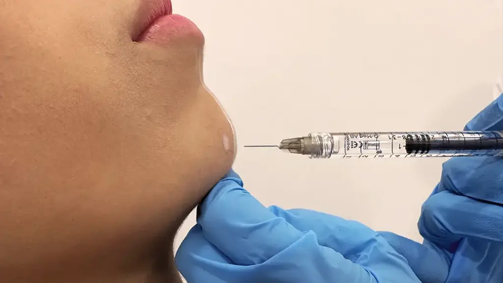 Relleno Facial Mentón