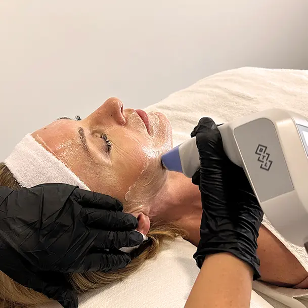 Exilis Facial Completo