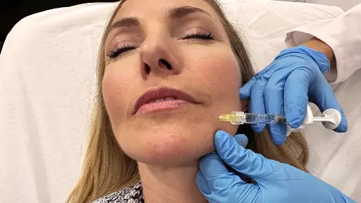 Relleno Facial Arco Mandibular